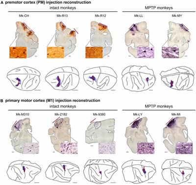 Cortical Projection From the Premotor or Primary Motor Cortex to the Subthalamic Nucleus in Intact and Parkinsonian Adult Macaque Monkeys: A Pilot Tracing Study